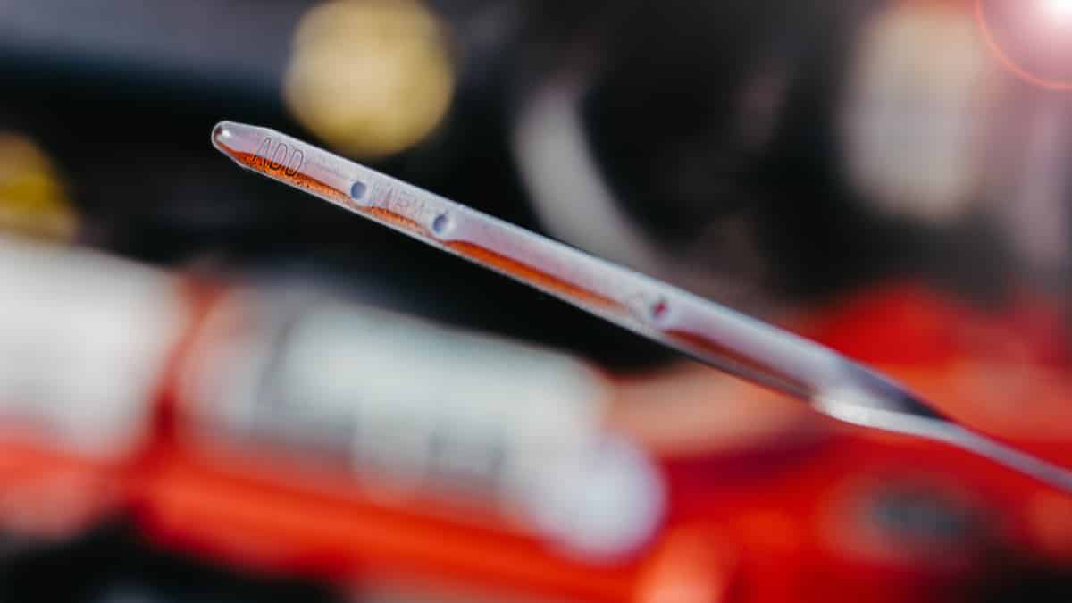 ناقل الحركة